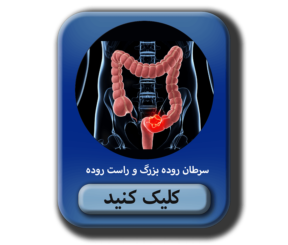 سرطان روده بزرگ دومين سرطان شايع در ايالات متحده مي باشد مطلب در موردسرطان روده بزرگ