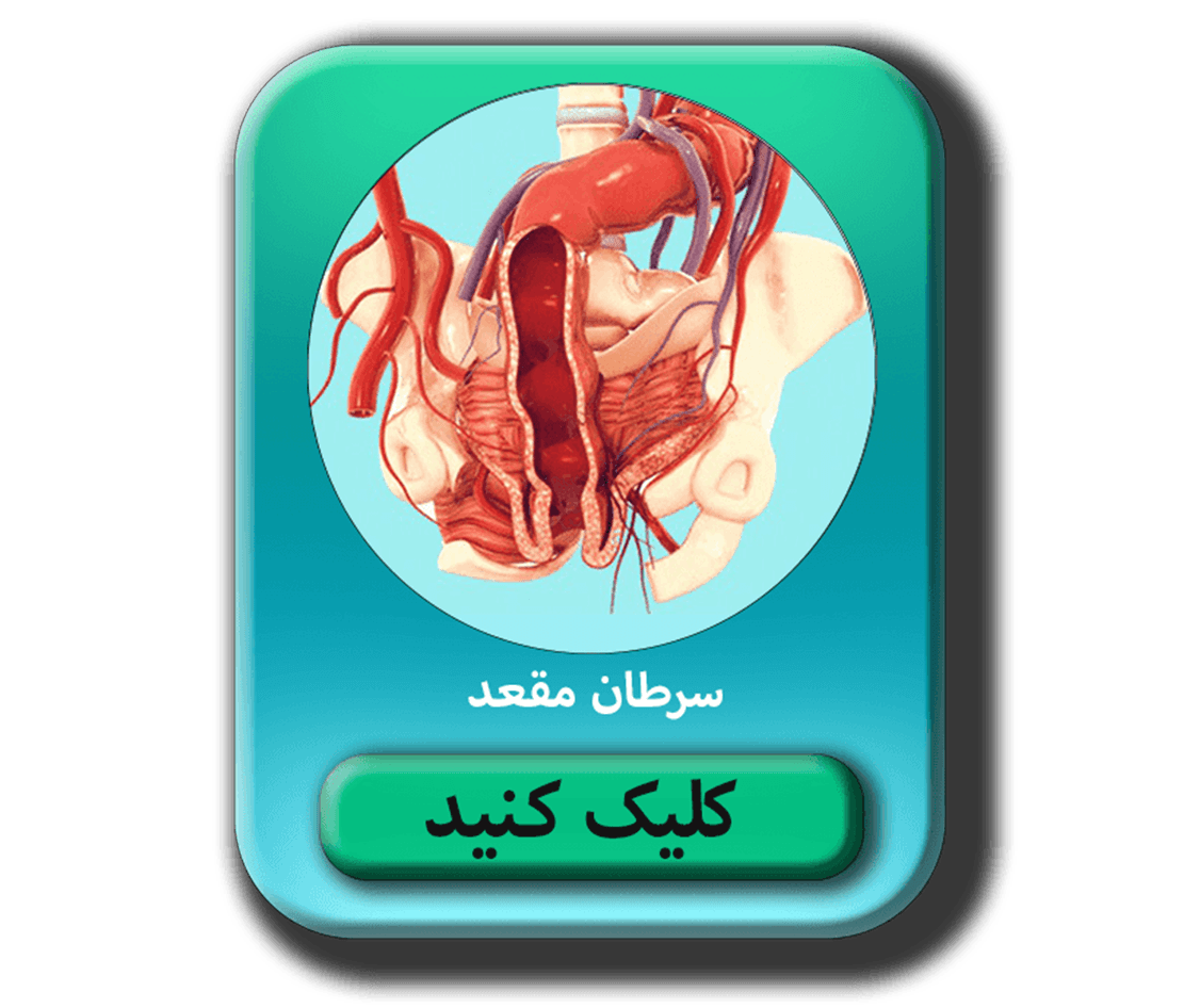 مطلب در مورد سرطان مقعد