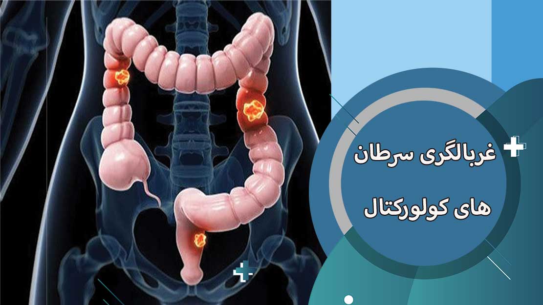 بهترین فوق تخصص جراحي کولورکتال 